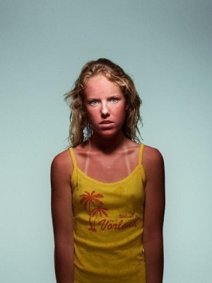 youngsunburn youngsunburn